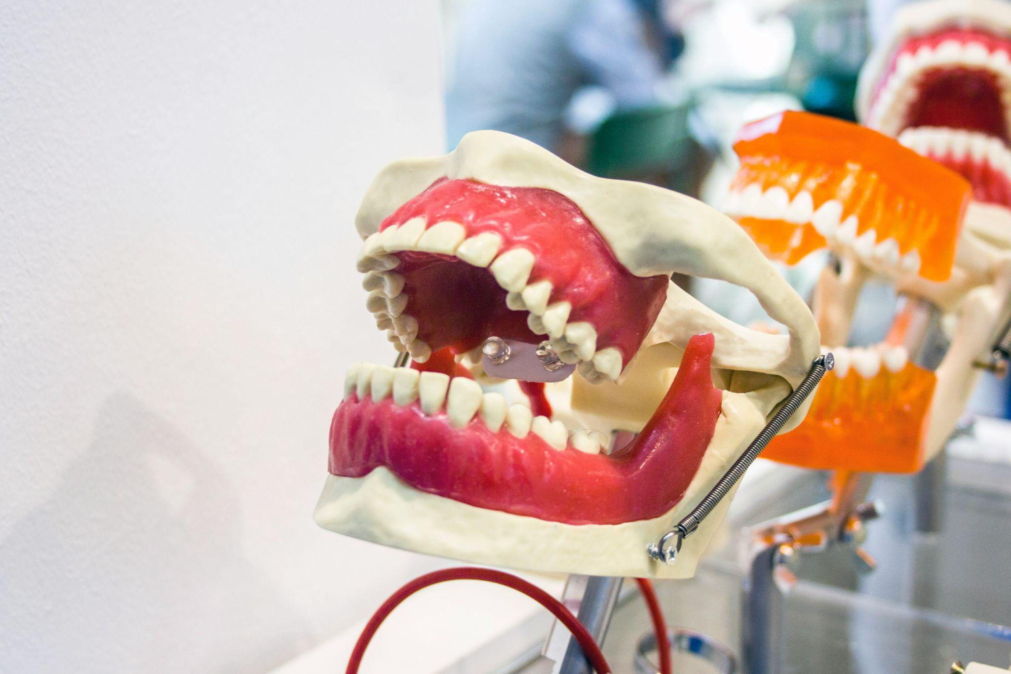Endodontic Treatment in Jersey City, NJ