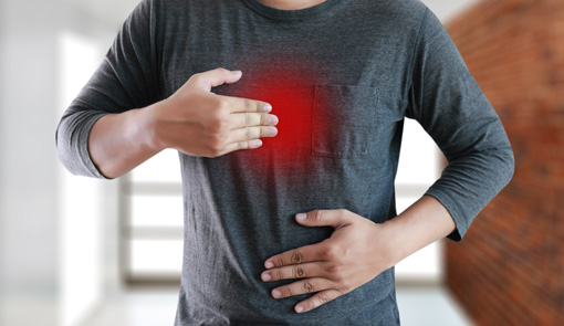 MAN with symptomatic acid reflux